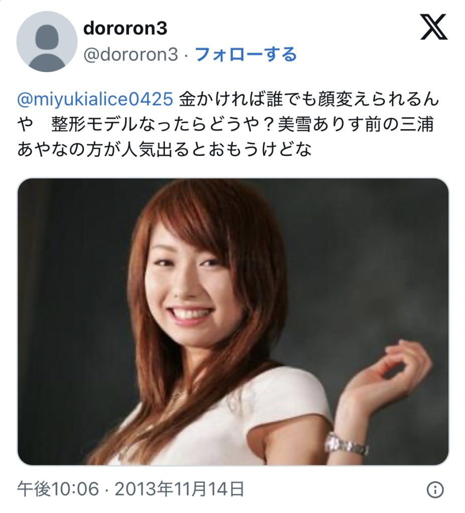 美雪ありす三浦綾菜整形